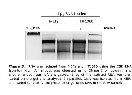 🍁 CSR RNA Extraction Kit