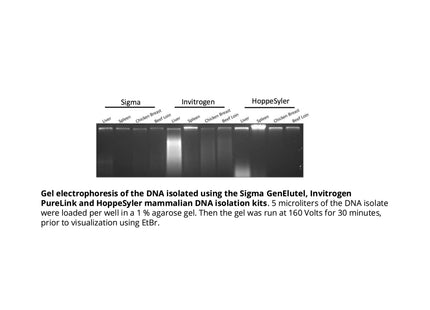 HoppeSyler Mammalian Genomic DNA Purification Kit