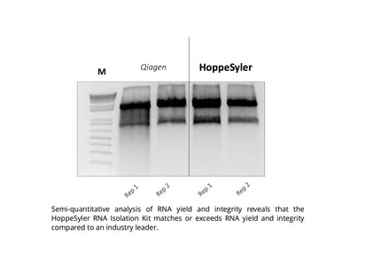 HoppeSyler Mammalian RNA Purification Kit