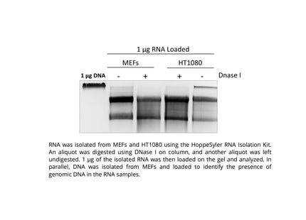 HoppeSyler Mammalian RNA Purification Kit
